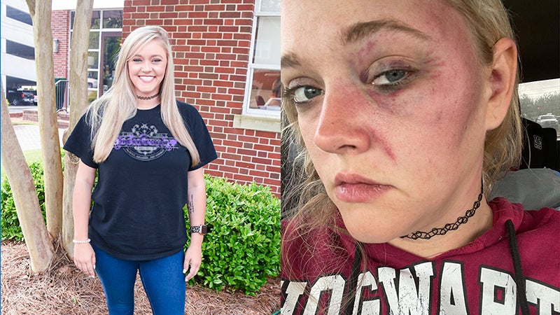 LaGrange native, TikTok influencer speaking out after becoming victim of  domestic violence - LaGrange Daily News | LaGrange Daily News